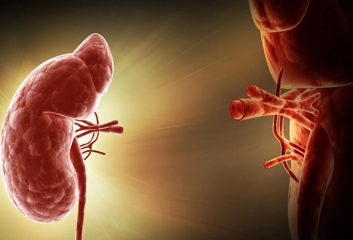 kidney transplant in delhi